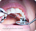 dental picture